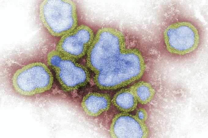 Gripe H3N2: como evitar quais os sintomas e a eficácia da vacina