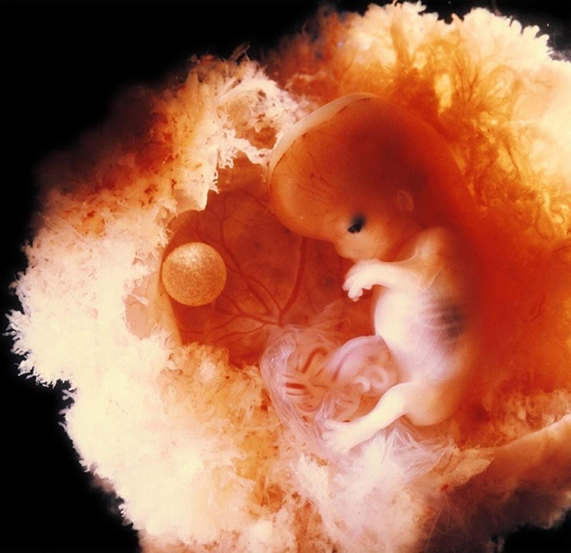  ABORTO EM CASO DE ESTUPRO