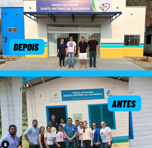 Posto de saúde de Santo Antônio da Cachoeira ganha novo espaço e equipamentos após reforma