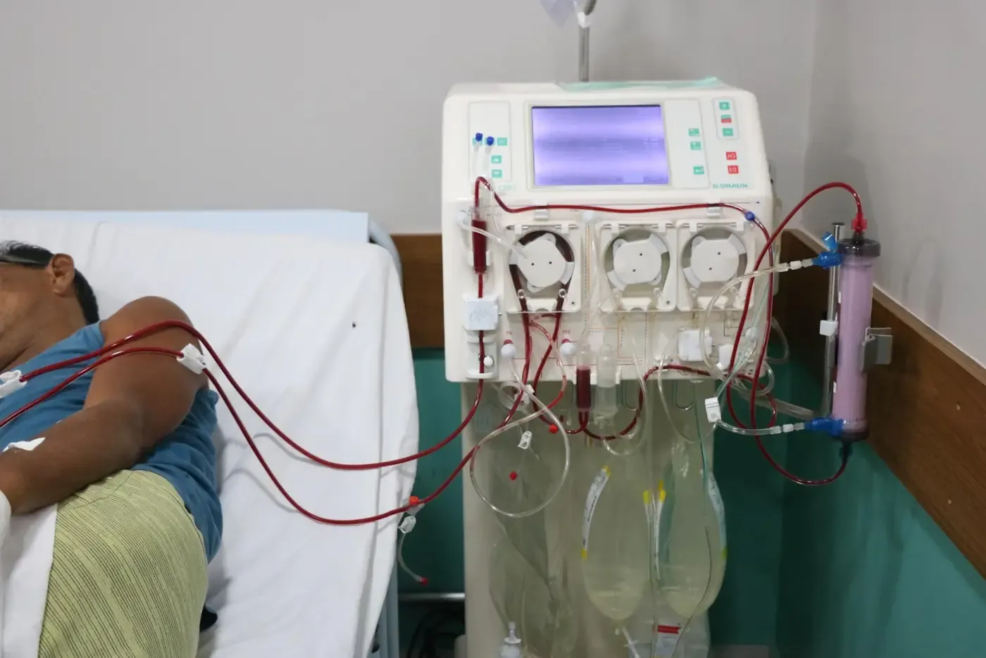 Governo do Amapá entrega primeira enfermaria de hemodiálise dentro do Hospital de Emergência, em Macapá