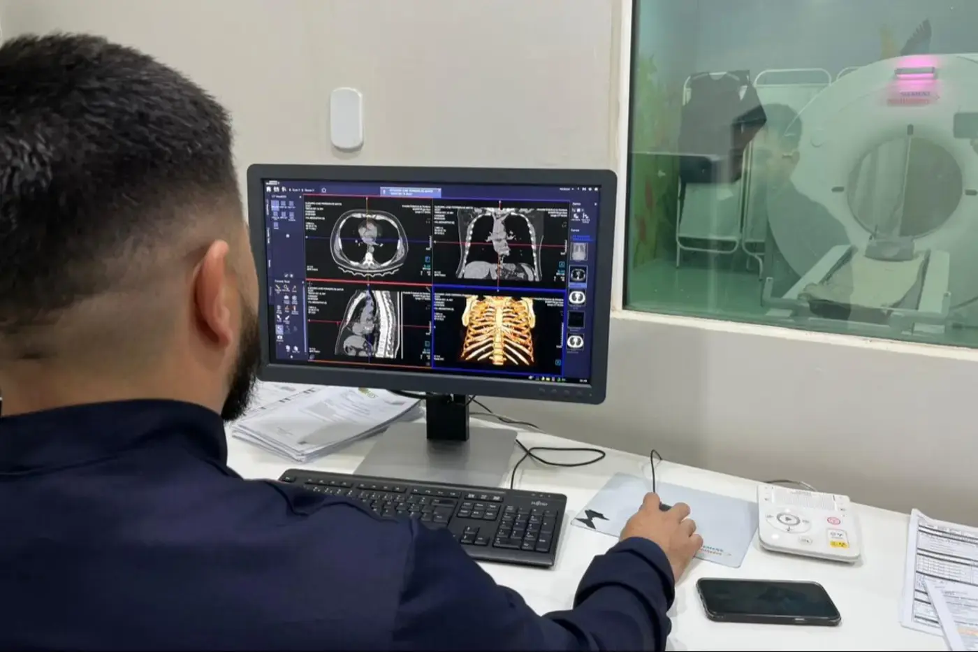Governo do Amapá registra quase 10 mil tomografias no Hospital Estadual de Santana